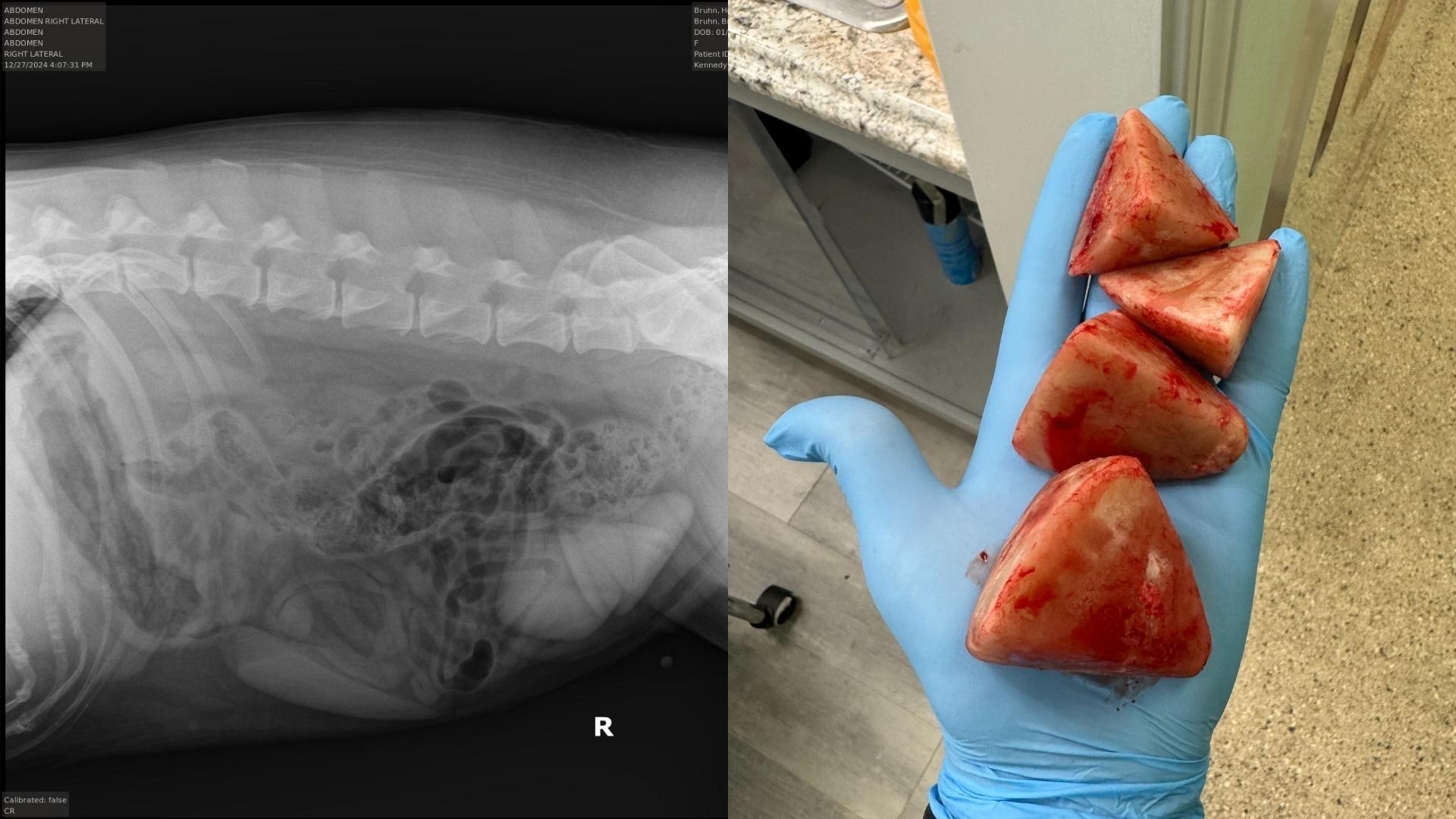 Cystotomy (Bladder Stone Removal)