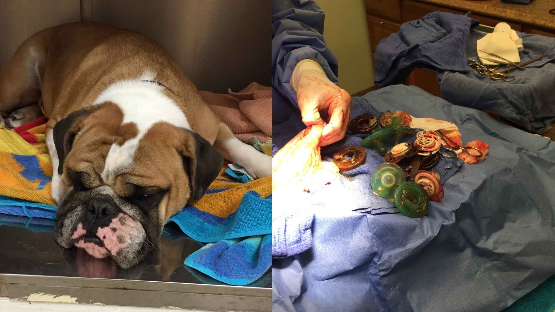 Foreign Body Removal